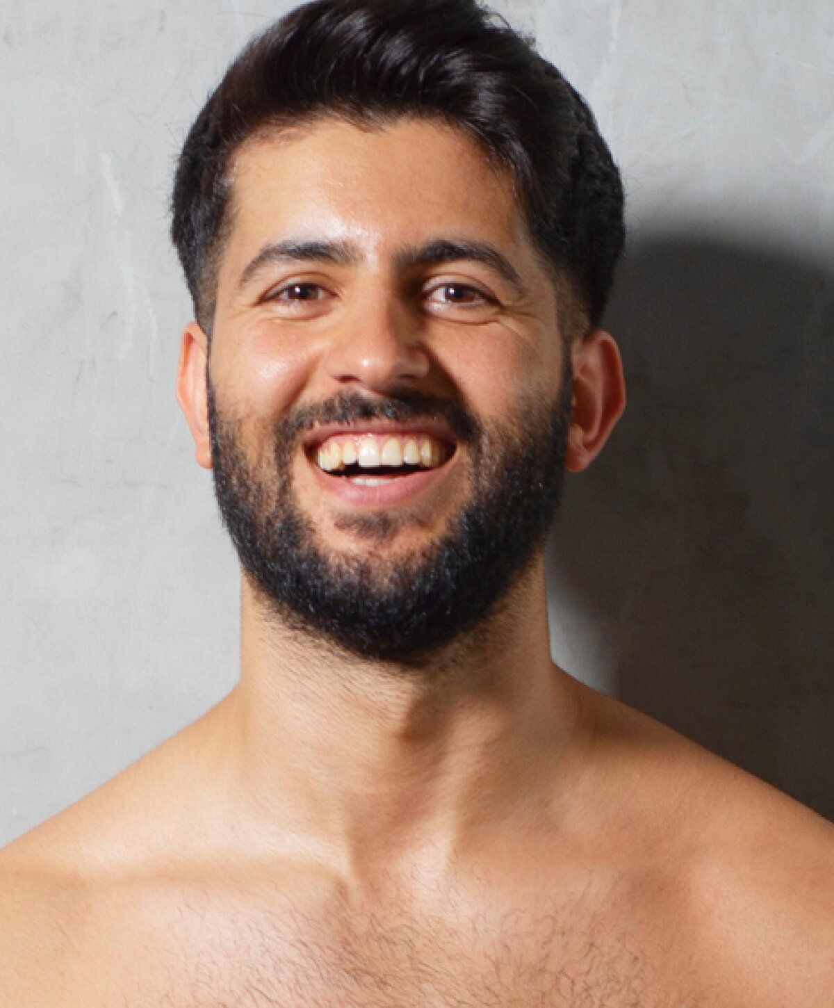 zinc thymulin hair restoration patient model with a beard against a plain background.