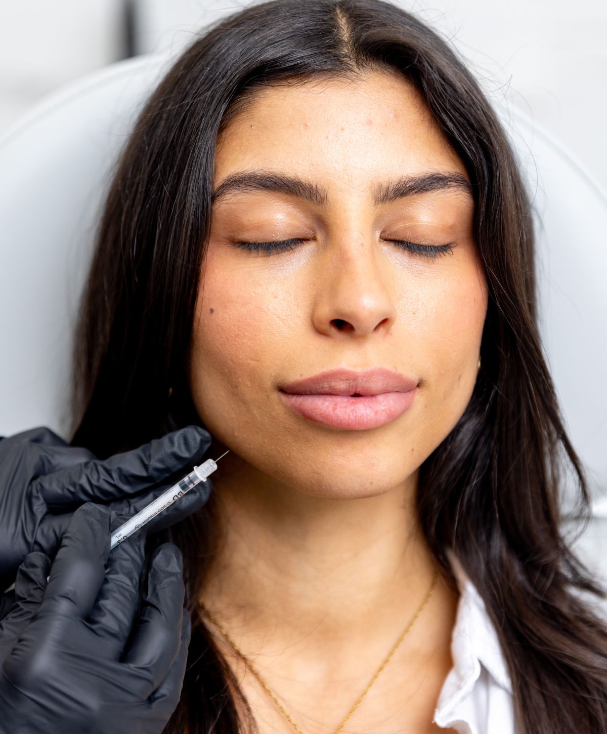 boynton beachfacial volume loss treatment patient model receiving an injection