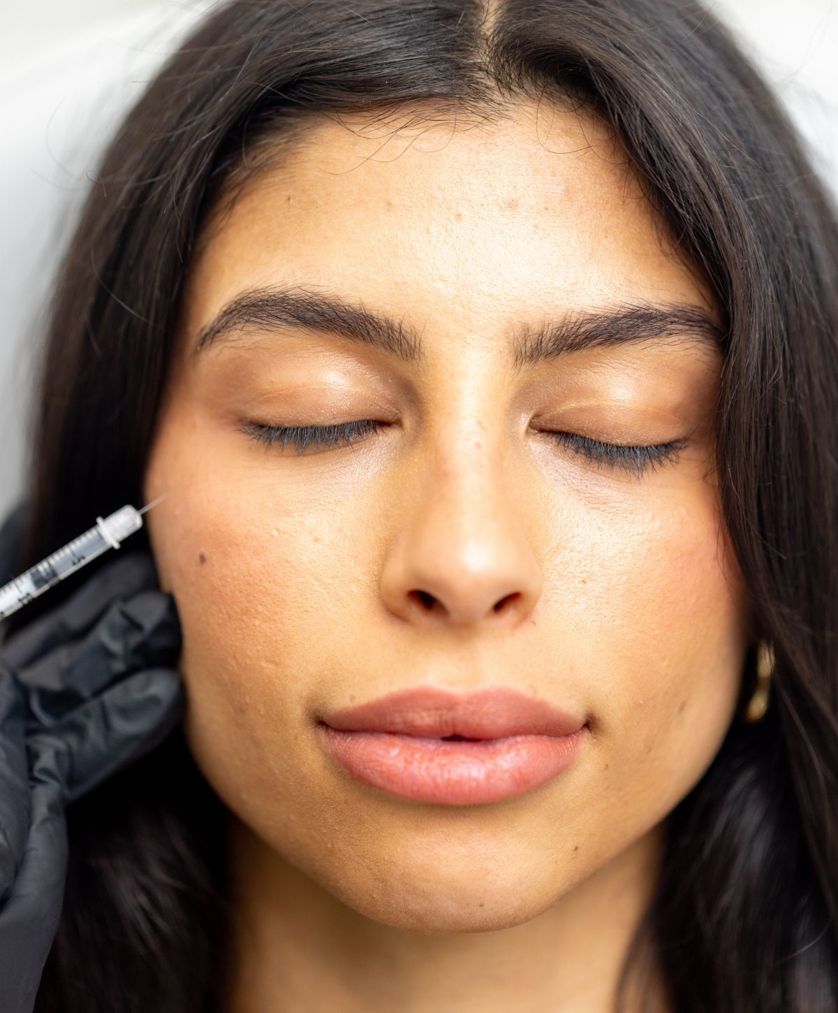botox patient model receiving injection on her cheek.