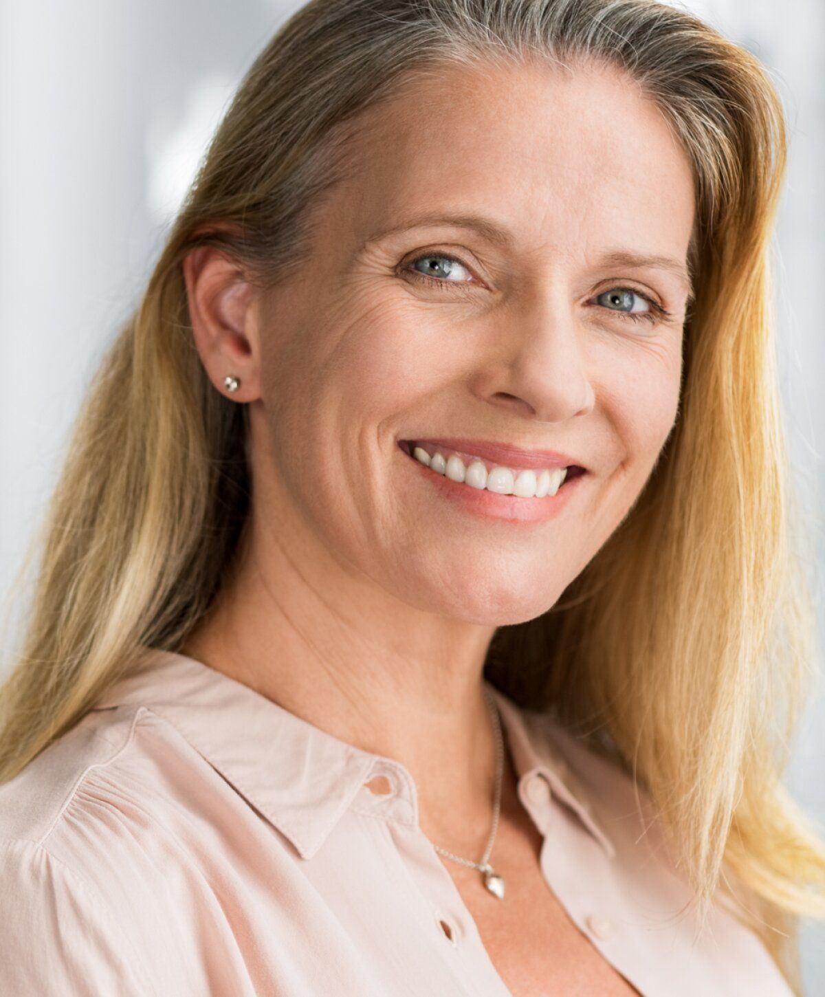 patient model smiling after boynton beach wrinkle treatment