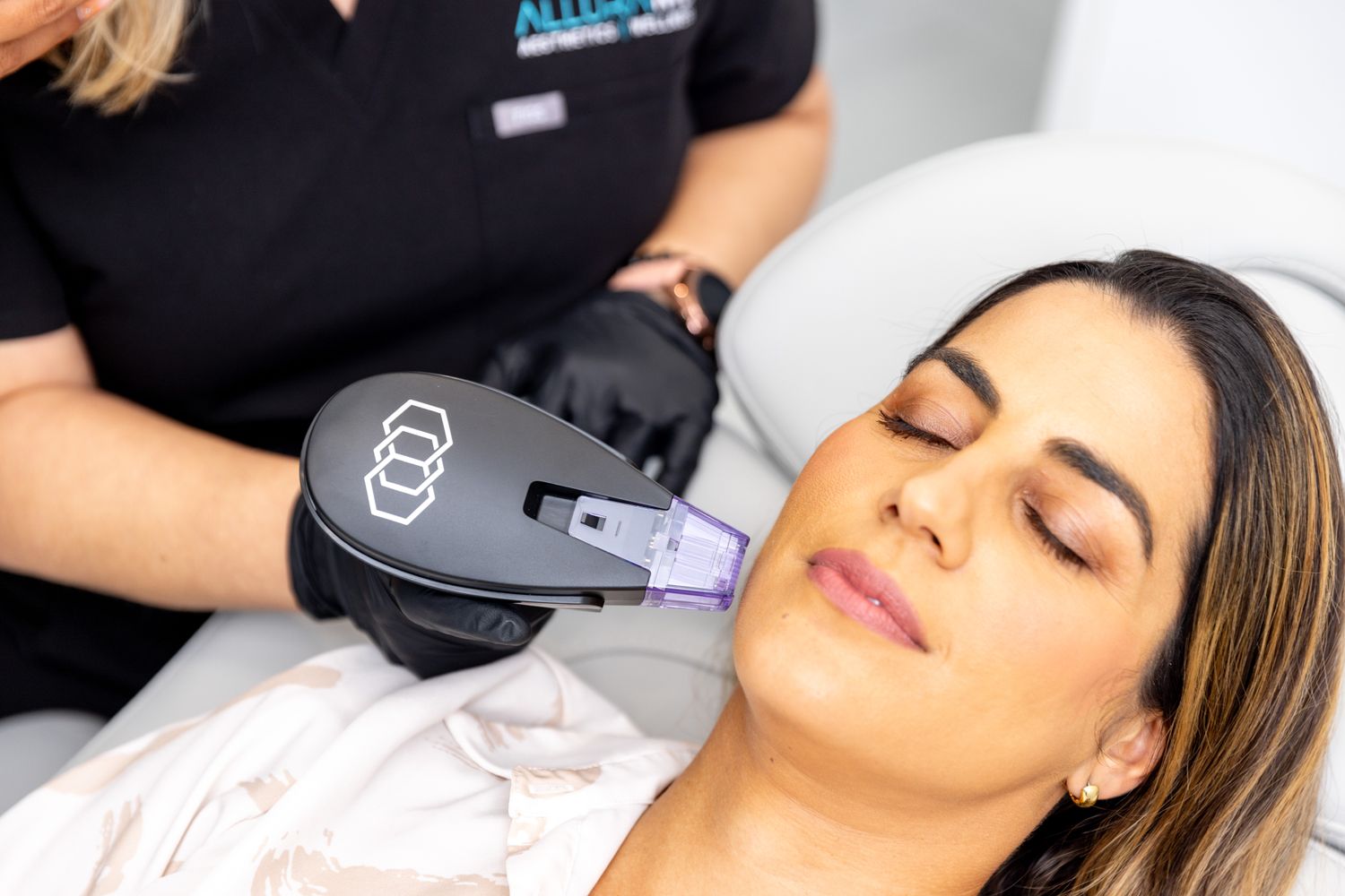 Morpheus8 rf microneedling patient model receiving treatment